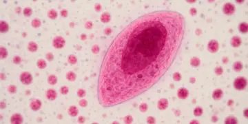 One in three at risk of blindness from overlooked parasite infection